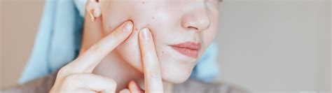 natural teen|13 tips for managing teen acne .